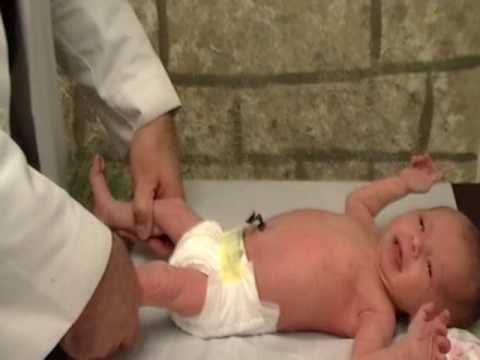 infant hip exam for profesionals