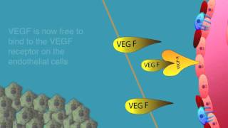 Angiogenesis