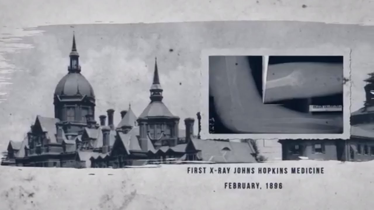 The Evolution of Radiology Johns Hopkins Medicine YouTube