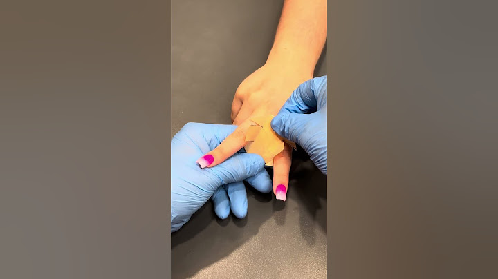 WYCIĘTY PLASTER NA ROZWIDLENIE PACÓW — JAK WYCIĄĆ? ZOBACZ!