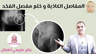 المفاصل الكاذبة و خلع مفصل الفخذ | خلع الورك عند الاطفال | علاج طبيعى أطفال | تابع حلقة مدرسة CME