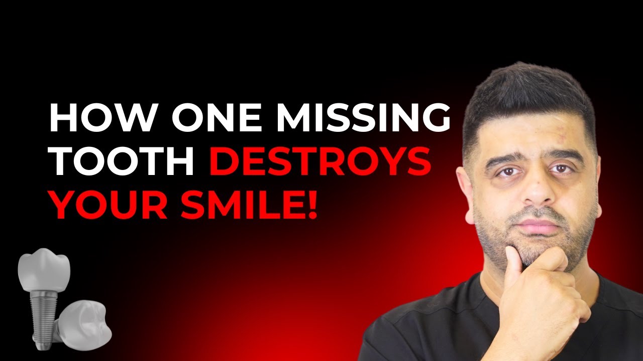 This Is Why Missing ONE Tooth Can Destroy Your Whole Smile!😳