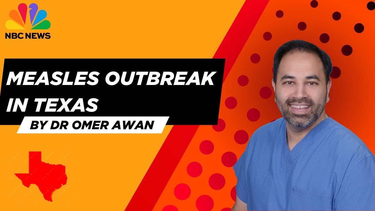 Measles Outbreak In Texas- A Doctor On NBC News Explains What You Need ...