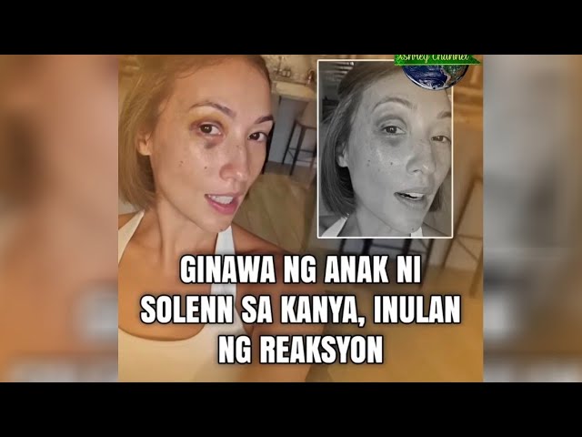 Solenn Heussaff nagtamo ng black eye dahil sa ginawa ng anak - YouTube
