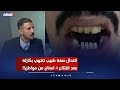 انتحال صفة طبيب تنتهي بكارثة بعد اقتلاع 4 اسنان من مواطن تفاصيل غير متوقعة مع رفيف الحافظ اي نيوز