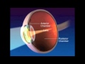 Anatomie de l'oeil 