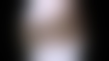 Arthroscopic Inside-Out Meniscus Repair of Bucket Handle Tear