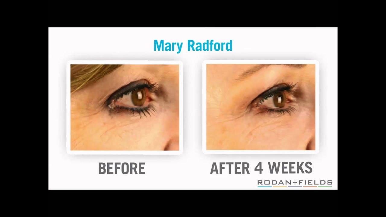 Introducing ACUTE CARE from Rodan + Fields - YouTube