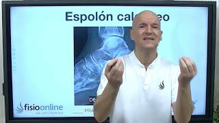 Causas, diagnóstico y tratamiento integrativo del Espolón Calcáneo