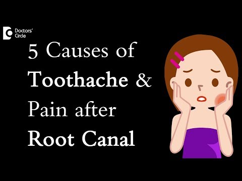 5 Causes of toothache and pain after root canal - Dr. Manesh Chandra Sharma