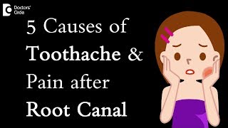 5 Causes of toothache and pain after root canal  Dr. Manesh Chandra Sharma