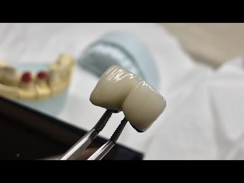 Ատամնատեխնիկ կերամիկական ատամներ