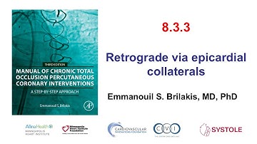 8.3.3: Manual of CTO PCI - Retrograde via epicardial collaterals