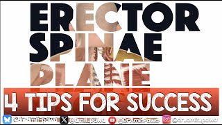 ESP UPDATE - Tips for success