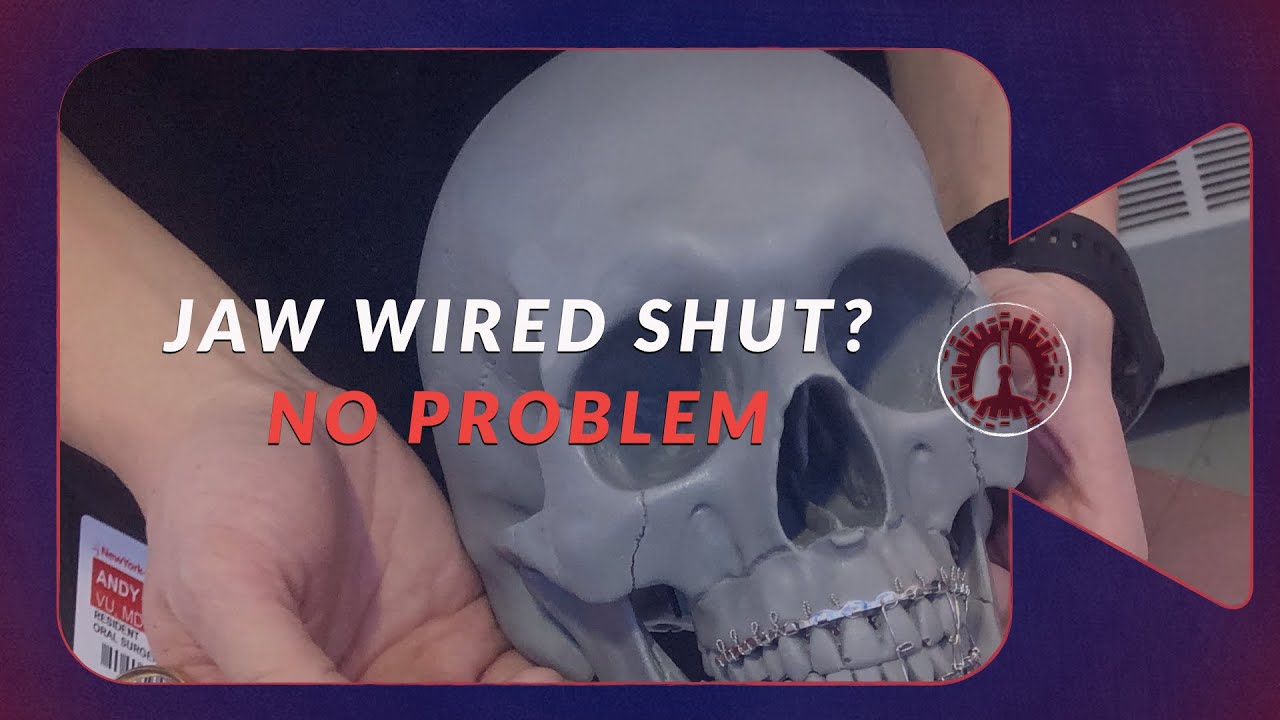 Jaw Wired Shut During an Airway Emergency. How to Fix it Even if You