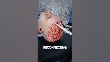 Thumbnail of Brain Transplant 😨 (Explained)
