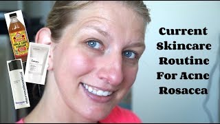 Current Skincare Routine For Acne Rosacea | Dermalogica and The Ordinary