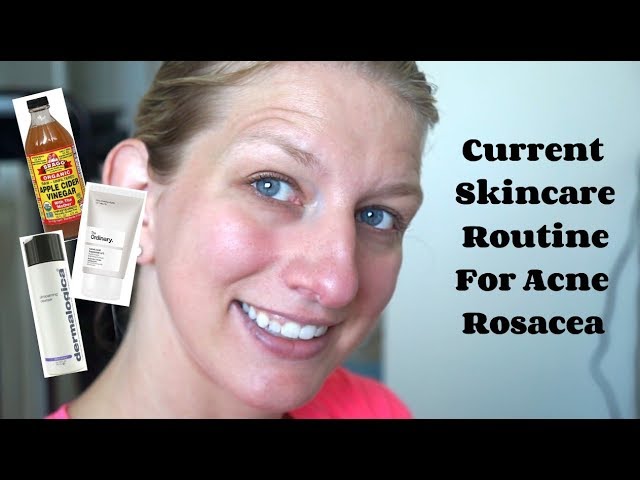 the ordinary skincare routine rosacea