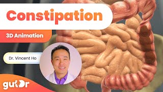 Constipation | The GutDr Explains (3D Gut Animation)