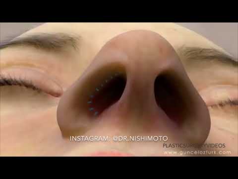 Vídeo: Como deixar o nariz menos bulboso?
