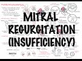 Mitral Reguritation (insufficiency) - Overview (signs and symptoms, pathophysiology, treatment)