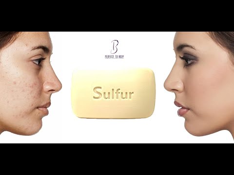 فوائد صابون الكبريت لتبييض البشرة