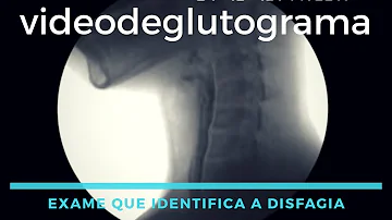 Onde faz o exame Deglutograma?