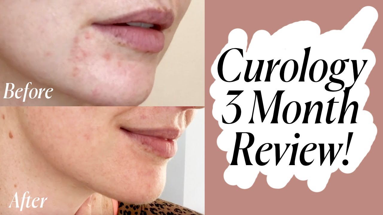 hírességek által használt anti aging krémek baby quasar anti aging eszköz