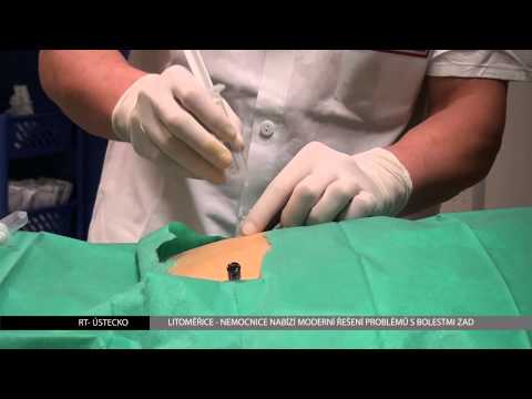 Video: 4 způsoby léčby bolesti pohybového aparátu bez chirurgického zákroku