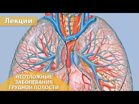 Часть 1. КТ при неотложных заболеваниях органов грудной полости. Андрей Мангов