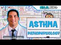 Pathophysiology of Asthma