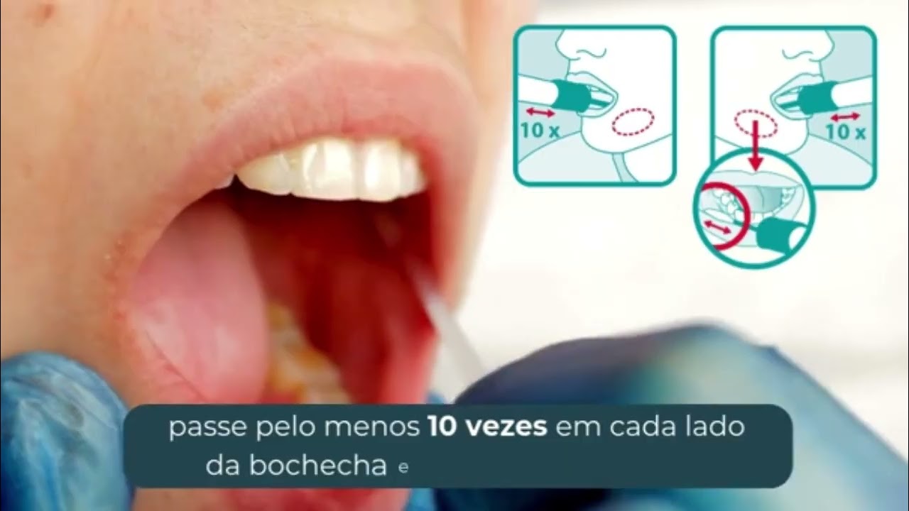 FÁCIL, PRÁTICO E SEGURO. Este vídeo ilustra a coleta de exames genéticos em domicílio, na sua própria casa.

Você receberá o Kit de Coleta via sedex, com todas as orientações detalhadas para realizá-lo com segurança em sua casa.  

Caso precise de informações adicionais ou orçamentos entre em contato conosco por email falecom@cligen.com.br ou por whatsapp (27) 99730-4763.

A Cligen | Genética Médica Avançada é uma clínica especializada em aconselhamento genético, com suporte laboratorial e consultas médicas (presencial e online - telemedicina), para pessoas de todas as idades.
