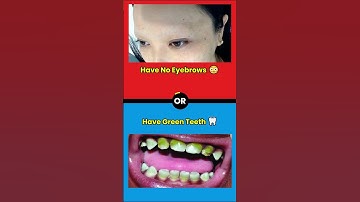 😲 Insane Would You Rather Questions That Will Stump You! 🔥#shorts #wouldyourather