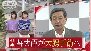 林経済産業大臣が入院　大腸の病気で来週にも手術(16/06/21)
