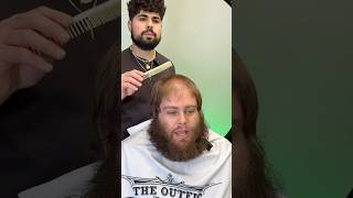 Destorys His Ultra Thin Hair Pittsburgh Arealink In Bio To Book