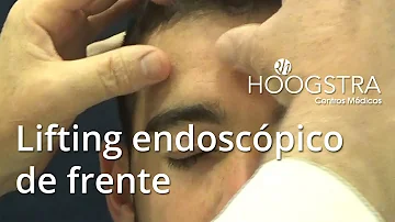 ¿Cómo se elimina la grasa por encima de las cejas?