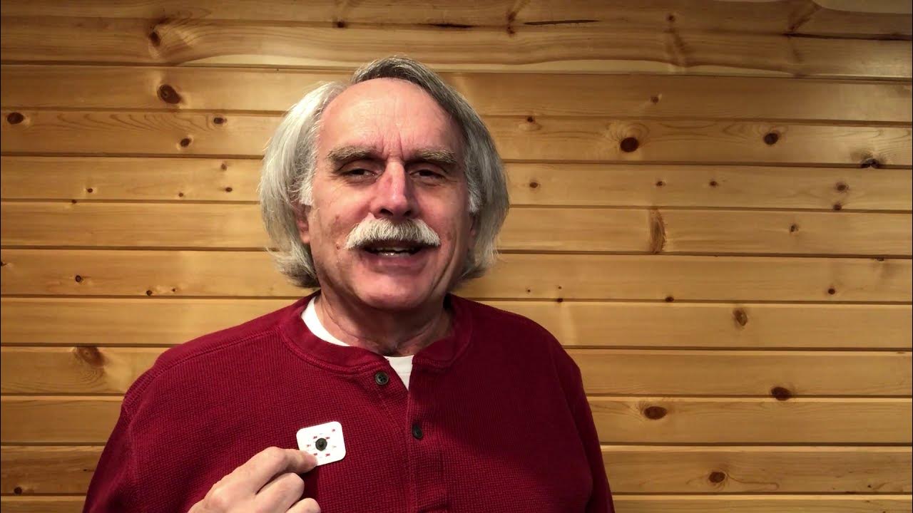 Removing 3M Red Dot Electrodes Semi Painlessly YouTube