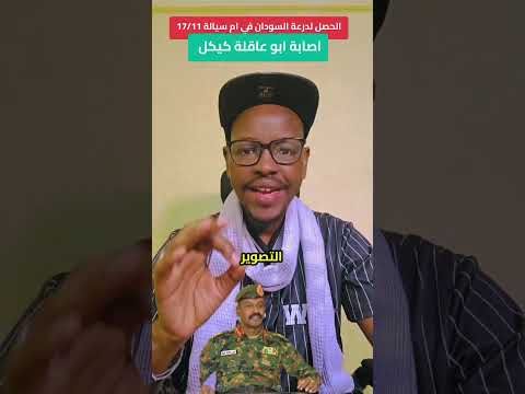 اصابة كيكل في معـ ـارك كردفان