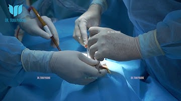 Bác Sĩ Trần Phương: Nâng Mũi Cấu Trúc Sử Dụng Vách Ngăn