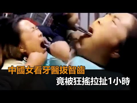 到底要拔了沒？中國女看牙醫拔智齒　竟被暴力狂搖「拉扯1小時」－民視新聞