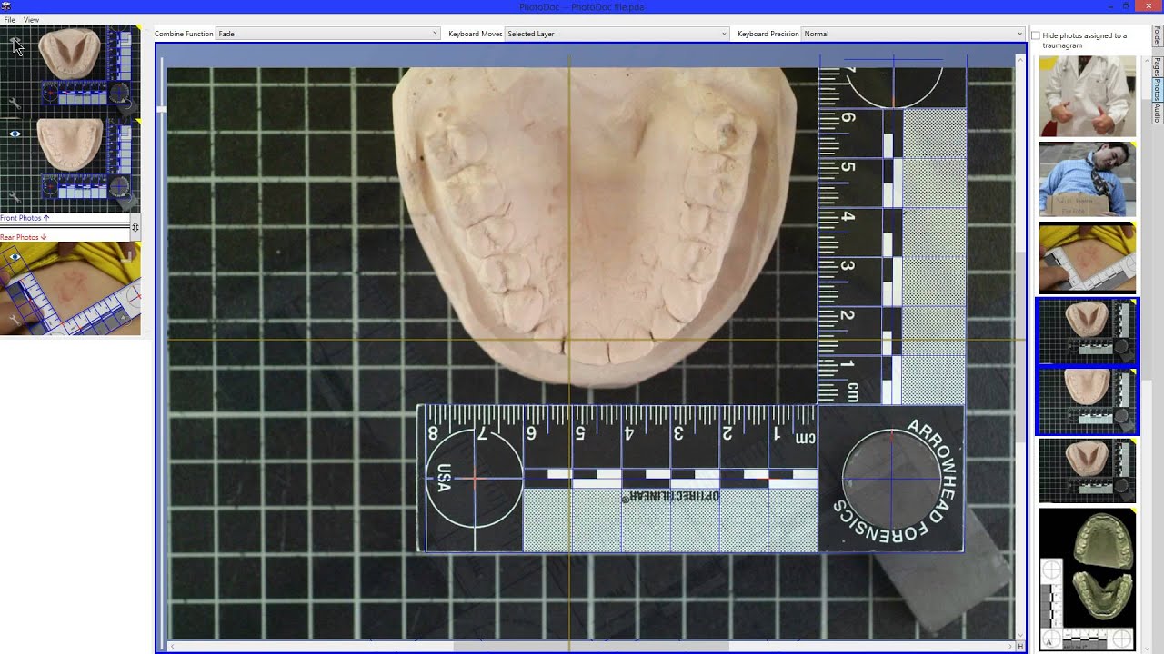 Photodoc PhotoDoc V2-V3 transition Video - YouTube