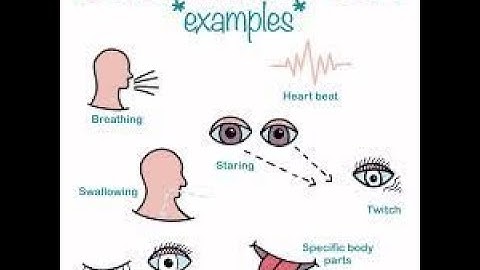 Explaining Sensorimotor OCD