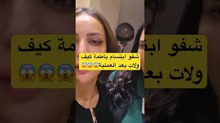 شفو ابتسام باطمة كيف ولات بعد عملية التجميل😱#ابتسام_باطمة #دنيا_باطمة_أخبار_المغرب_  #دنيا_بطمة