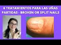 Treatment  for BROKEN NAILS or  SPLIT NAILS.  💅  6 TrataMientoS para UÑAS PARTIDAS. 💅