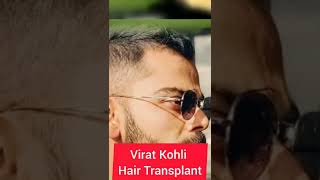 Virat Kohli Hair Transplant | Celebrity Hair Transplant | Indian Cricket Team #shorts screenshot 4