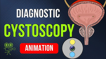 DIAGNOSTIC CYSTOSCOPY ANIMATION