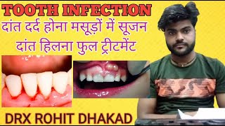 Tooth infection. दांतों में दर्द होना, मसूड़े फूलना,मसूड़ों में खून आना, दांतों में खून आना केसे thi