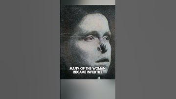 The Disturbing Fate of the Radium Girls