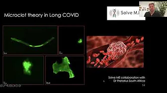 Skeletal Muscle Fatigue & Post-Exertional Malaise in People w/Long Covid & Implications for ME/CFS