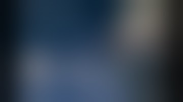 Module 6: orbital decompression. Dr Shahz Ahmed.  2024 International FESS course Ghent